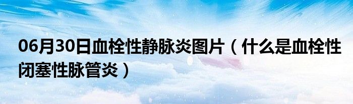 06月30日血栓性静脉炎图片（什么是血栓性闭塞性脉管炎）