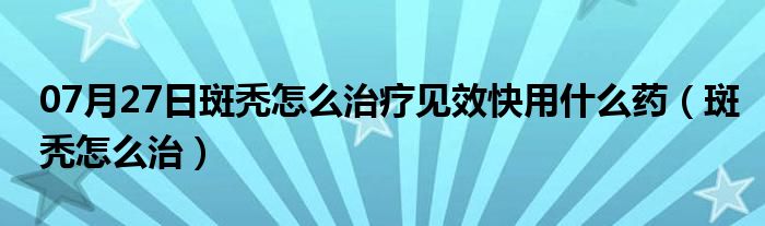 07月27日斑秃怎么治疗见效快用什么药（斑秃怎么治）